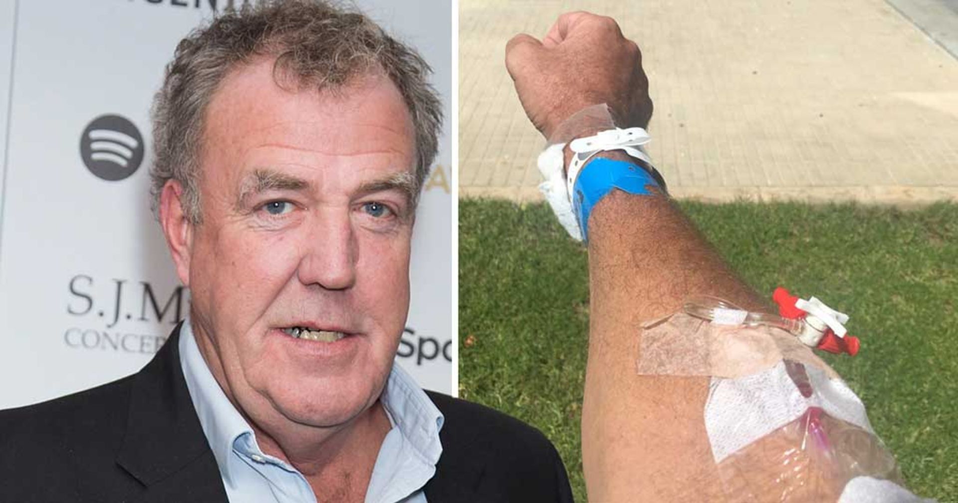 clarkson-injury