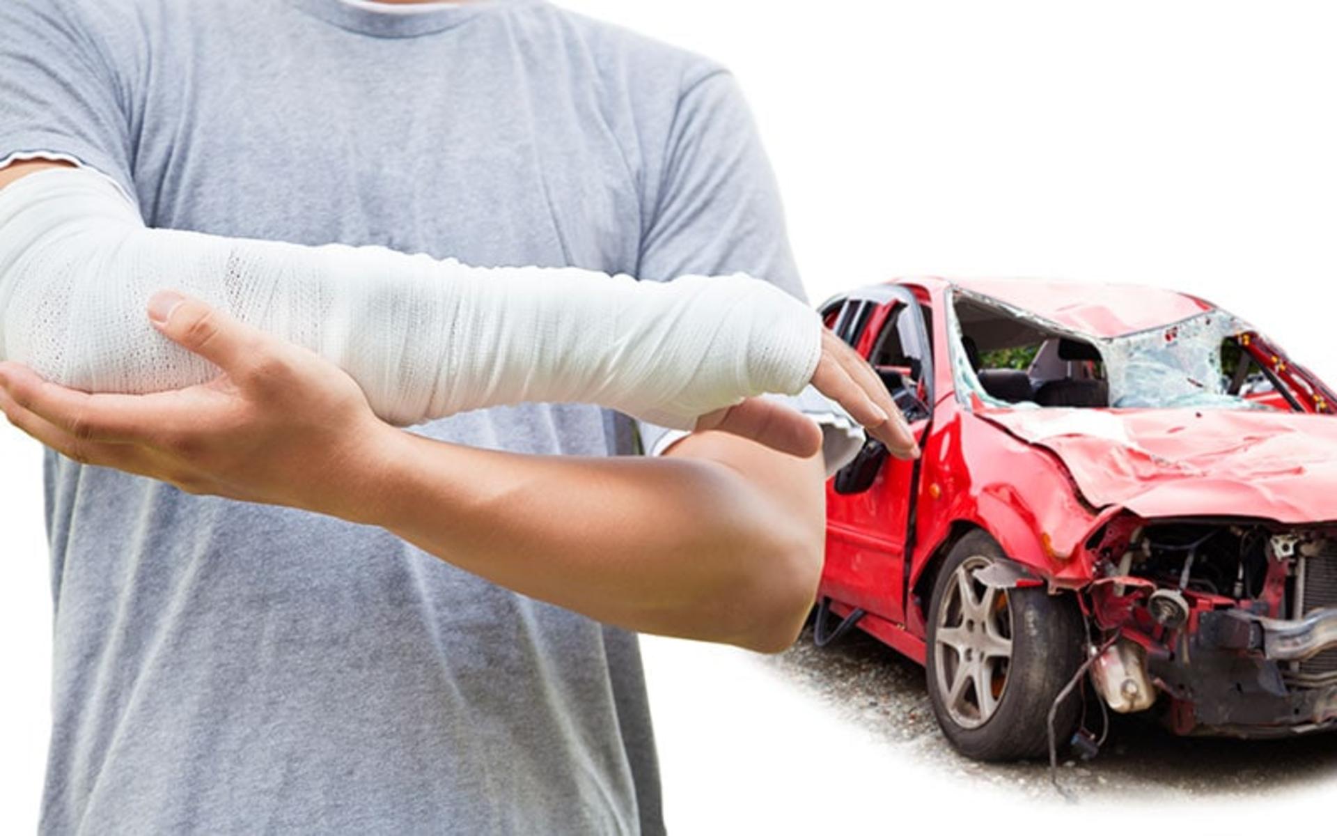 car-accident-injuries-to-arms-and-legs